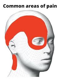 Image result for Headache Self-Help Measure