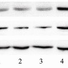Routine Blood Test Results Of The Benzene Exposure Groups Download Table