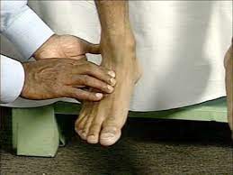 Palpate Arterial Vessels Of Lower Extremity