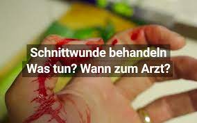 Wartet man zu lang mit der operation, lassen sich die sehnenenden oft nicht mehr aneinandernähen. Schnittwunde Richtige Behandlung Versorgung Praktischarzt