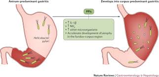 Ppi use is associated with increased odds of developing ckd and death: Proton Pump Inhibitors Understanding The Complications And Risks Nature Reviews Gastroenterology Hepatology
