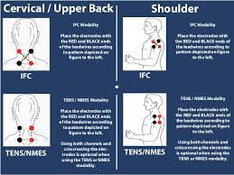 Zmpczm016000 12 11electrode Placement On Cervical Upper Back