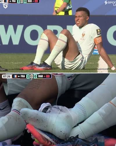 Mbappe chấn thương