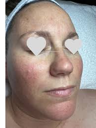 Brooke Olson- Makeup Artistry & Esthetics