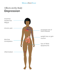 Also, symptoms markedly interfere with your normal functioning. The Effects Of Depression On The Body And Physical Health