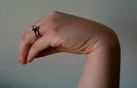 Image result for Tetany