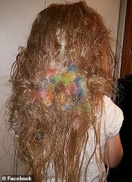 Resist the urge to cut it out with scissors. Mother Warns Others About Bunchems After The Toy Became Matted In Daughter S Hair Daily Mail Online