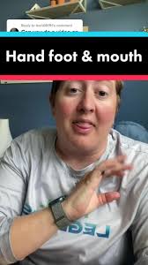 Replying to @leah08191 Hand, foot, mouth (&booty) is a common viral  infection that causes rash, fever and miserable kids!  #handfootandmouthdisease #pediatrics #virus