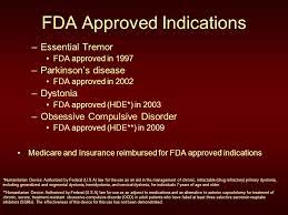 Deep Brain Stimulation Ppt Video Online Download