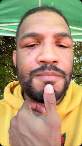 I wanna help as many young fighters and athletes as possible. Once I’m  recovered I’ll start posting instructionals and drills that I was putting  together for skool here for free. This page has a lot ...