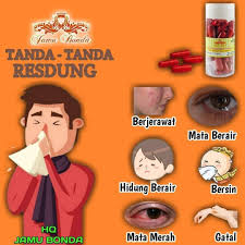 Maybe you would like to learn more about one of these? Tanda Tanda Resdung Alsalaman