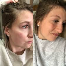 Okay so I'm 25 now and should probably start looking after myself🫠 can  anyone tell me what vitamins I should be taking for healthy skin, hair etc.