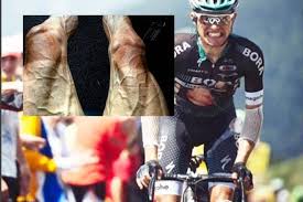 Tour de france riders have minimal body fat, so there's no soft layer under the skin to mask the veins, which are essentially sitting closer to the surface. Tour De France This Image Shared By Pawel Poljanski After 16 Stages Will Give You Sleepless Nights The Financial Express