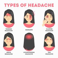 Image result for Acute Localized Headache