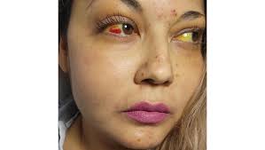 Fundraiser by Denise Canela : Help my sister get her transplant