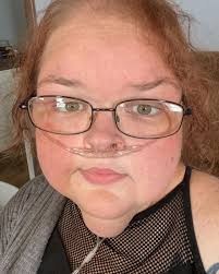 1000 Lb Sisters' Tammy Weight Loss Photos: Before and After