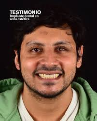 Dr. Nicolás Soto Á.