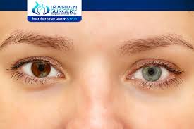 Eye Color Change Surgery Cost 2020 Eye Color Change Surgery Cost In Iran