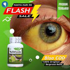 Maybe you would like to learn more about one of these? Obat Penyakit Kuning Asli Hepatitis Mata Kuning Obat Penyakit Hati Dan Empedu Liver Herbal Alami Shopee Indonesia