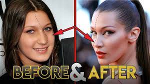 Bella hadid at the 2010 grand slam for children benefit concert. Bella Hadid Before And After Transformations Plastic Surgery Rumors Make Up Fitness More Youtube