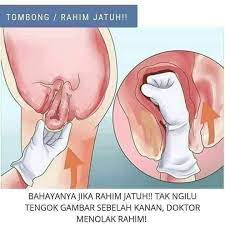 Ikuti cara menanam cengkeh beserta pembudidayaannya mulai dari proses penanaman bibit, perawatan, hingga panen buahnya. Rahim Kembang Rawat Dengan Pink Lady Body Perfection Pink Lady Original Rahsia Kejelitaan Wanita Bermula Di Sini