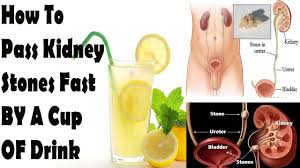 Pin On Health Wellness