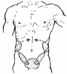 Pain In The Belly Or Gut Hesperian Health Guides