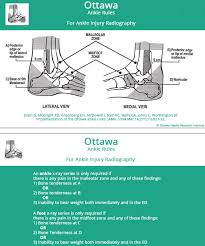 Ankle Sprain Foot Ankle Orthobullets