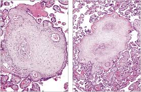 Image result for Endostemon villosus