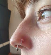 Need Help Do I Take My Nose Piercing Out I Was Pierced With A Stud Just Under 4 Months A Go And Then I Couple Of Weeks A Go I Went Back