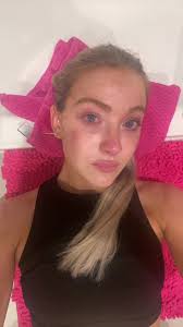 Christine Corbin Pepper Spray in Dc