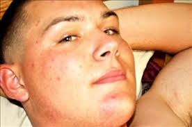 Adam J. Buyes Obituary (2011)