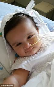 Rare conjoined twin sisters who were born in a set of triplets head into  hours-long surgery to be separated