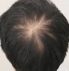 Hair loss can be devastating for both. 7 Days Plus Hair Growth Serum Stowkart