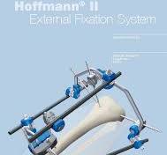Hoffmann® II External Fixation System