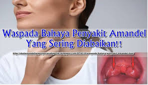 Pin Oleh Ai Susi Di Herbal Penyakit