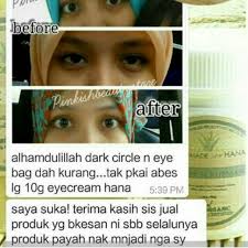 Berikut adalah tips can cara untuk hilangkan eye bag atau lingkaran gelap bawah mata ini: Hilangkan Eyebag Firming Eye Cream Shopee Malaysia