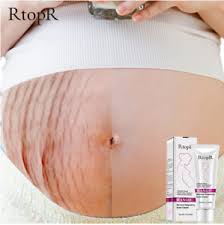 Crema Para Las Estrias Eliminar Celulitis Anti Estrias Abdomen Caderas Senos Ebay