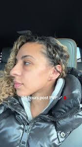 A little jump scare this morning #prp