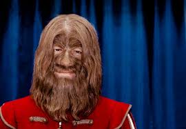 Image result for Hypertrichosis