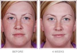 Why Obagi Before After Photos Obagi Medical Products Obagi Aging Skin Plastic Surgery