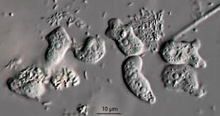 Image result for Micrargeriella