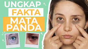 Dark circle liat nak hilang. Harus Tau 4 Jenis Dark Circles Cara Menghilangkan Mata Panda Youtube