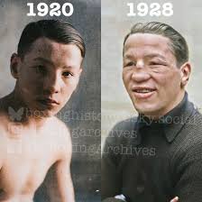 The Before and After of 1920s French and European lightweight champion Fred  Bretonnel is a grim reminder of how damaging the sport of boxing can be.  Bretonnel turned pro at 14 and