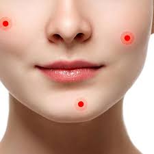 Quick Fix For Red Skin Is Nasal Spray Says Dr Pimple Popper Rachael Ray Show Natural Oils For Skin Diy Acne Treatment Skin Redness