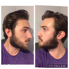 As with so many things, building a strong foundation always pays off over time. 20m My Beard Is Considerably Thicker Beneath My Jaw Line Than Above Am I Reaching Neckbeard Territory If So Any Tips On How To Even It Out Any Advice About The Neckline