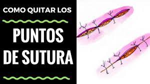 Como Quitar Los Puntos De Sutura De Una Cirugia En Perros Demostracion De Un Caso Real Youtube