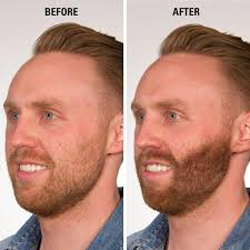 Cuvva is a step up in quality (and price) from the other best hair loss concealers so far in this list. 10 Best Hair Loss Concealer Reviews In 2020 Hold The Hairline