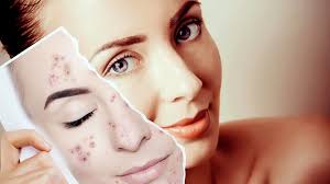 Tratamientos Faciales