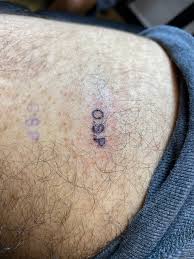 And tattoo ink ingredients like cadmium have been found in lymph nodes, which help filter. Tattoo Removal Before And After Reddit Tattoo Design